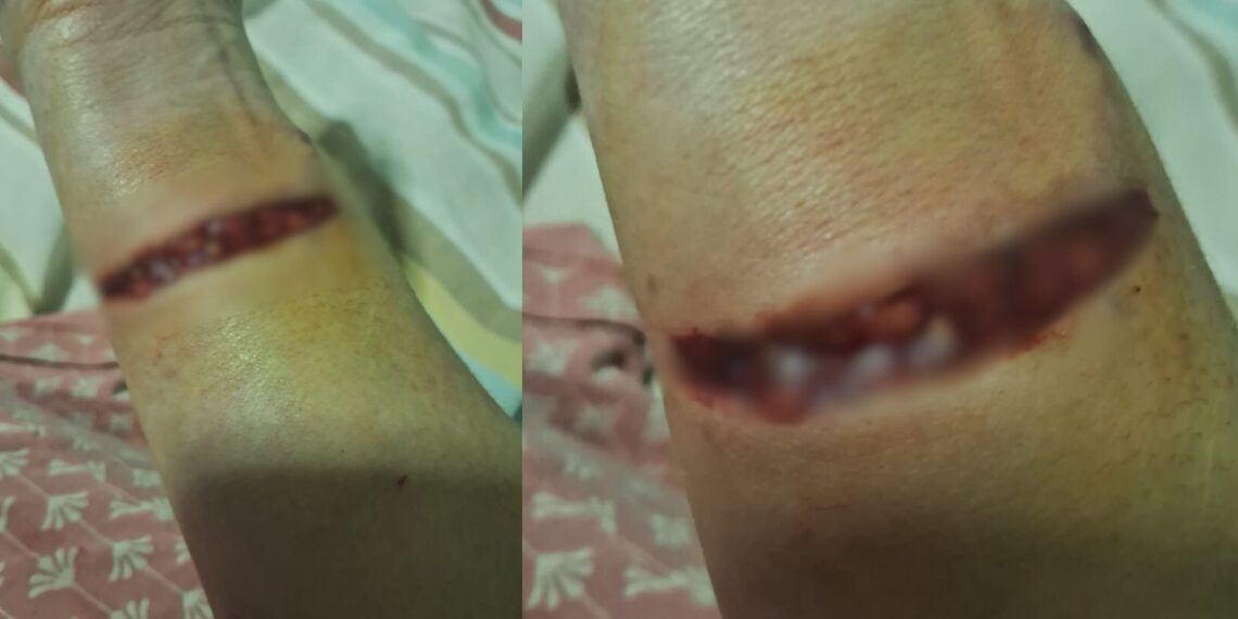 Ataques de cães deixam três feridos no Vale do Capão