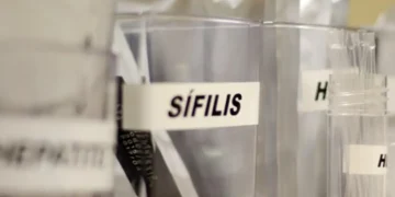 SUS passa a adotar antibiótico para prevenir sífilis e clamídia