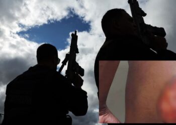 Polícia prende dupla suspeita de tortura e racismo contra homem com deficiência